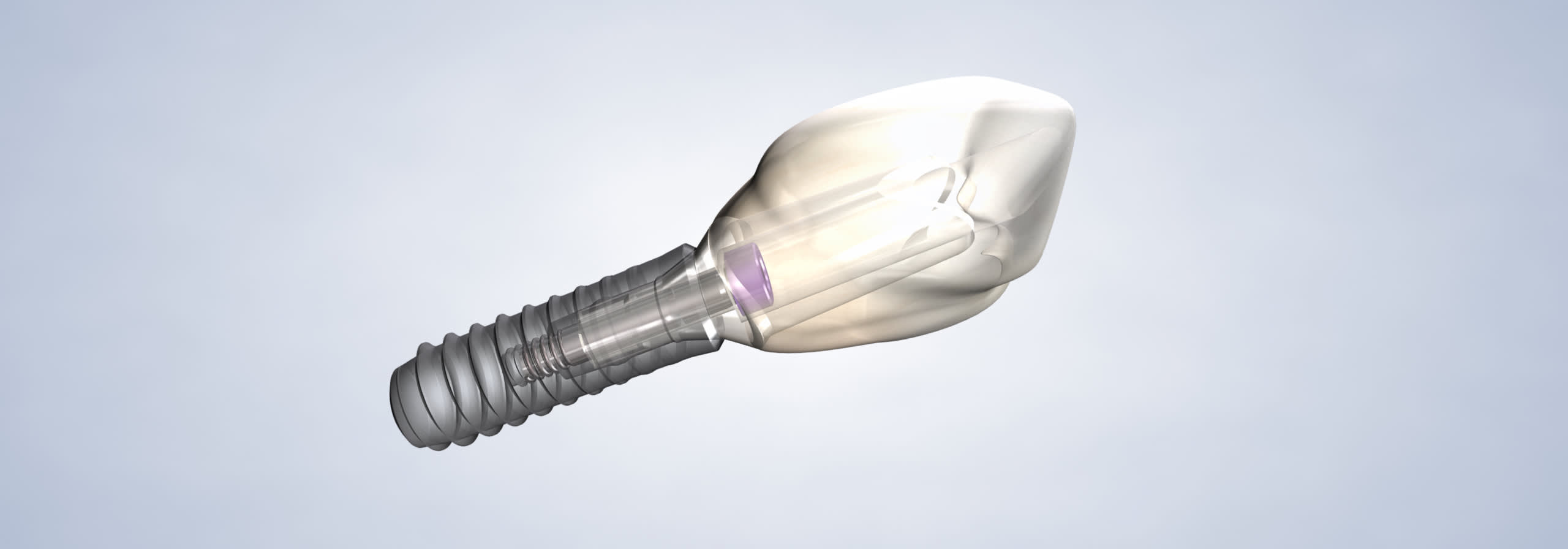 Dental implants procedure desktop