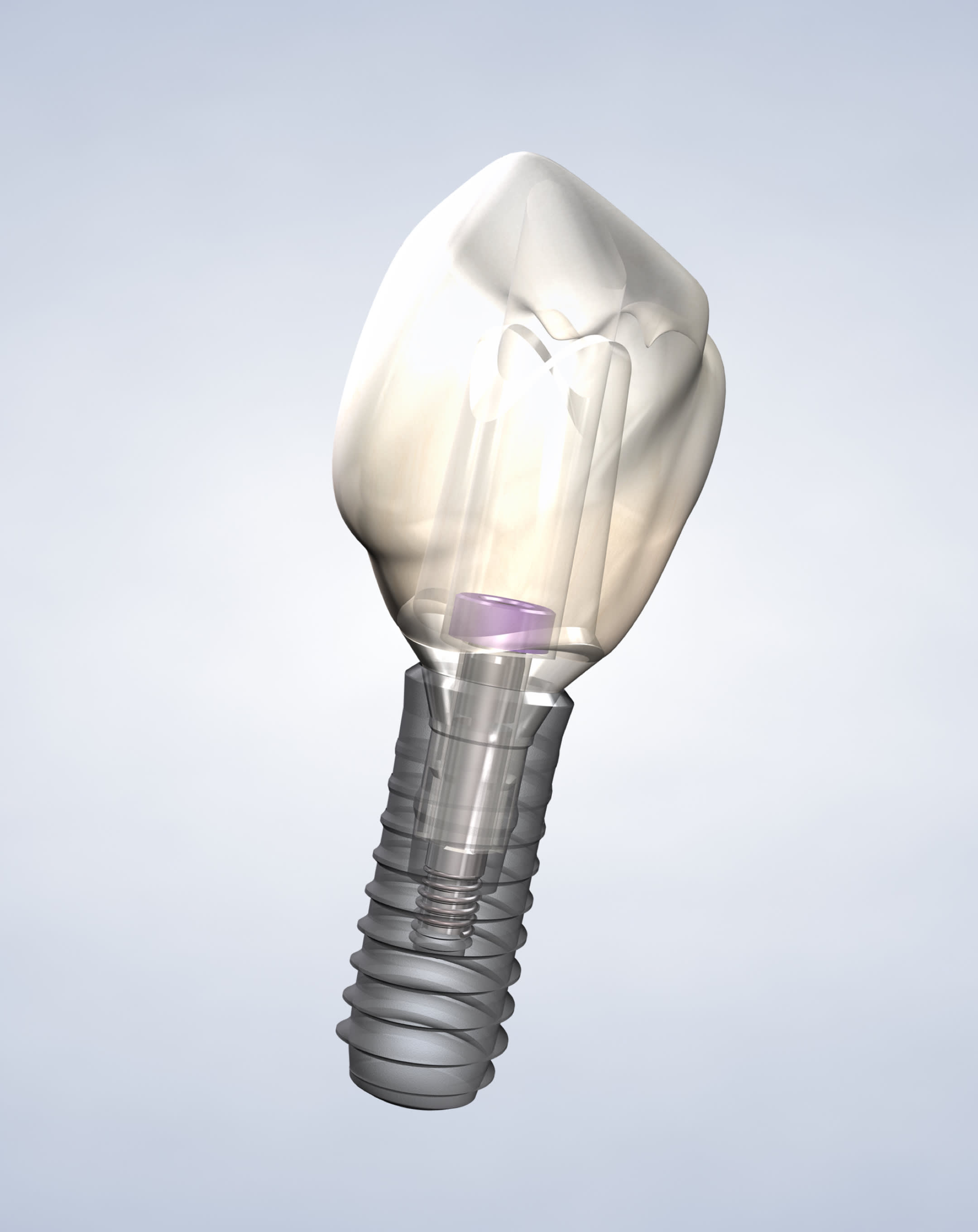 Dental implants procedure mobile