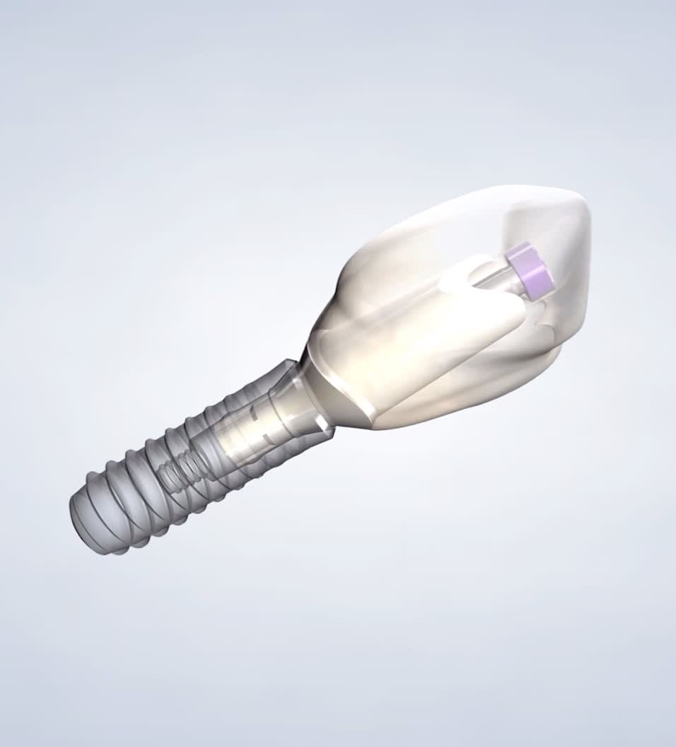 A 3D-rendered image of a dental implant with a screw-like base and a capped top on a light gray background.