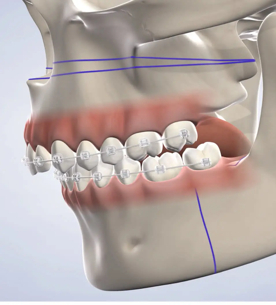 A 3 d image of the front teeth and gums.