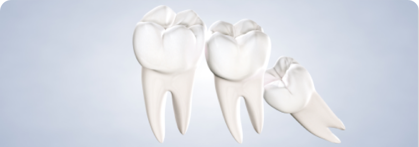 A tooth with two different types of teeth.