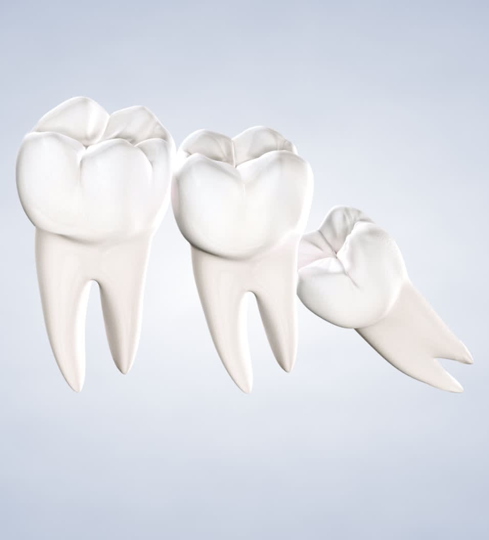 Illustration of three human molar teeth against a light blue background.