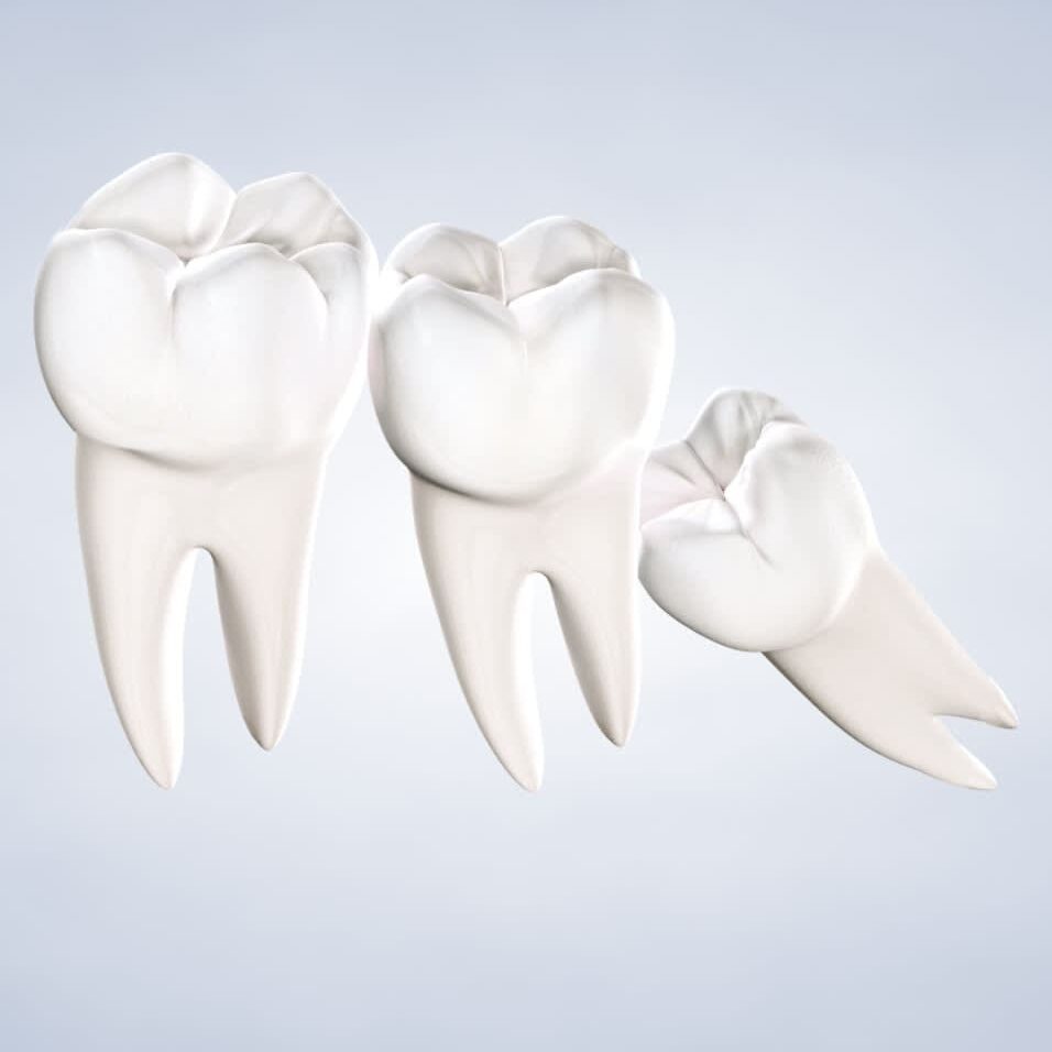 Three white dental teeth models.